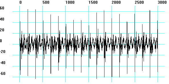 Vibration signal of the bearing with an outer-ring defect, showing repeated sharp impacts